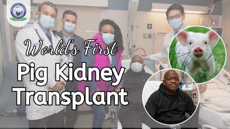 First Pig Pig Kidney Transplant के पहले मानव लाभार्थी की मृत्यु हो गई | Khan ...